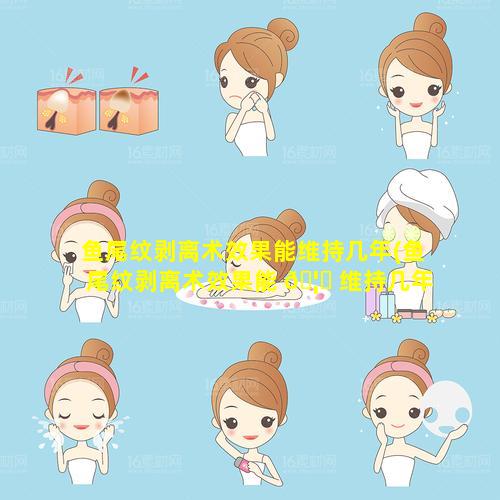 鱼尾纹剥离术效果能维持几年(鱼尾纹剥离术效果能 🦊 维持几年时间)